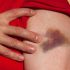 Seated Tai Chi Exercise Can Improve Recovery For  Stroke Patients