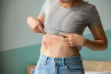 Shingles Associated with Increased Risk for Stroke and Heart Attacks